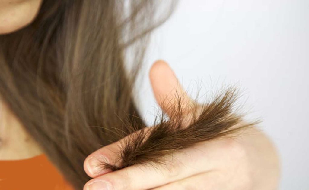 علاج تقصف الشعر